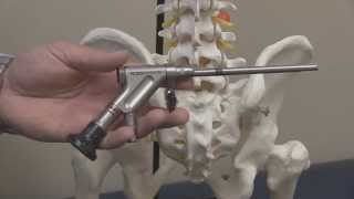Endoscopic Discectomy. By Dr. George Rappard.