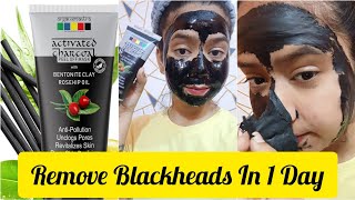 Organix Mantra Bamboo Charcoal Peel OffMask removes blackheads #organixmantra #charcoalmask #peeloff