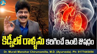 కిడ్నీలో రాళ్ళను కరిగించే ఇంటి ఔషధం! Remedy for Kidney Stones. #Shorts