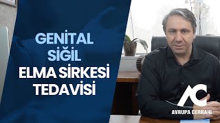 Genital Siğil Elma Sirkesi Tedavisi | Avrupa Cerrahi