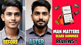 Man Matters Beard Gummies Review |  Do They Really Work for Beard Growth | beard growth |