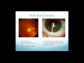 Scleral Lens Indications