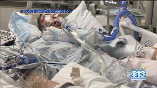 Man Survives Vaping-Related Illness