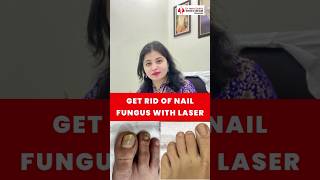 How to cure NAIL FUNGUS?