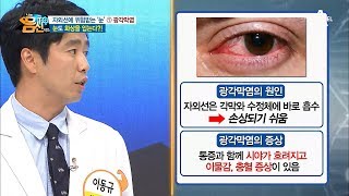 눈도 화상을 입는다! 실명의 주범 ‘자외선’! | 나는 몸신이다