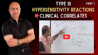 Hypersensitivity Reactions Type 3 | Part 1