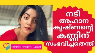 നടി അഹാന കൃഷ്ണൻ്റെ കണ്ണിന് സംഭവിച്ചതെന്ത് |Actress Ahana Krishnan's eye| Ethnic Health Court