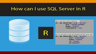 [R Beginners]: Beginner guide for connecting and using SQL Server in R. Code for Windows included.