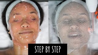 I Got A Professional Facial  Step By Step  Clearing Hormonal Acne