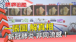 熱線追蹤 - 新冠病毒非流感 專家示警