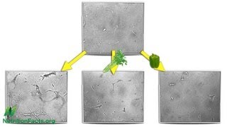 Anti-Angiogenesis: Cutting Off Tumor Supply Lines