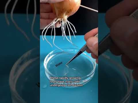 How many chromosomes are present in an onion cell at metaphase?