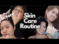 Day time and Night time skin care routine - pimples no more!! || GELLYACE