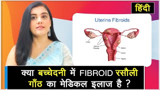 बच्चेदनी में फिब्रोईड (Fibroid) रसौली गाँठ को कैसे बिना Operation के Medicine से ठीक किया जाए ?