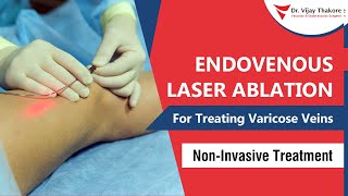 Endovenous Laser Treatment - Advanced Laser Treatment for Varicose Veins | Dr. Vijay Thakore