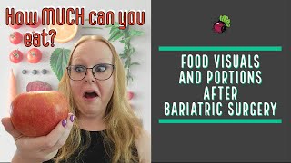 Food Visuals and Portions after WLS // How much CAN and SHOULD you eat? | My Gastric Bypass Journey