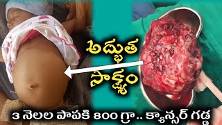 800 గ్రాముల క్యాన్సర్ గడ్డను పసిబిడ్డ నుండి తీసిన డాక్టర్స్. బిడ్డ గురించి తండ్రి ఇచ్చిన సాక్ష్యం.