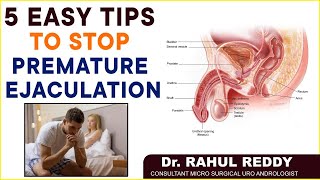 How To Stop Premature Ejaculation || Health Tips For Men || Dr Rahul Reddy || Socialpost Healthcare