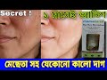 Mama Earth Bye Bye Blemishes | Usage , Overview | এক ক্রিমেই মেছেতার দাগ সহ সব দাগ ভ্যানিশ