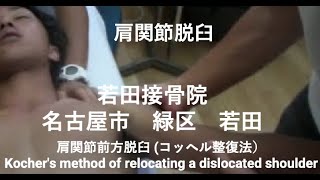 shoulder dislocation reduction 接骨院　緑区　肩脱臼コッヘル法　  Kocher's method of relocating a dislocated shoulder