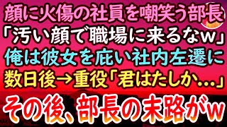 【感動する話】顔に火傷がある陰キャ社員を見下す上司「化粧くらいしろバケモノがw」彼女を庇った俺は窓際部署に社内左遷させられた。