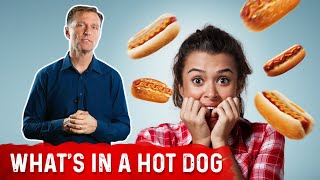 What is in HOT DOGS? Are Hot Dogs Good for You? – Dr.Berg