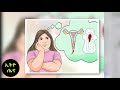 ethiopia የወር አበባን አለማየት በሽታ ወይስ ጤነኝነት what causes menstrual irregularities