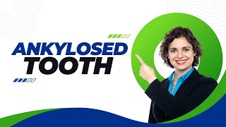 Ankylosed Tooth: Signs, Symptoms, and Cure