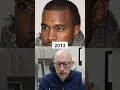 Kanye West Hair Loss Analysis