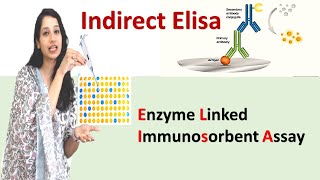 Indirect ELISA I Enzyme Linked Immunosorbent Assay I Easy & Detailed Explanation