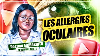 LES ALLERGIES OCULAIRES