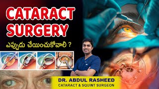 CATARACT కి పరిష్కారం ఏంటి ? సర్జరీ ఎప్పుడు చేయించుకోవాలి ? | Cataract Surgery | Dr Abdul Rasheed