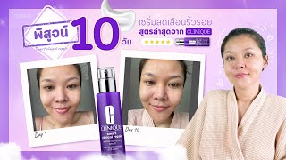 (เช็คสูตร)พิสูจน์ 10 วัน เซรั่มลดริ้วรอย Clinique ใหม่ ด้วยอนุพันธ์วิตามินเอสุดล้ำ ดีกว่ายังไง!!!?