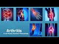 Arthritis - Symptoms And Causes | Dr. Joe Thomas, Consultant- Rheumatology