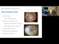 Lecture: Penetrating Keratoplasty: Intraoperative Steps and Management of Complications