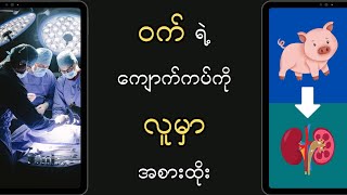 ဝက်ရဲ့ ကျောက်ကပ်ကို လူမှာအစားထိုးခွဲစိတ်မှု စမ်းသပ်အောင်မြင်ခဲ့တယ် ✅