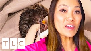 Headstrong Pilar Cyst | Dr. Pimple Popper: This is Zit