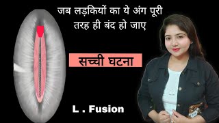 जब लड़कियों का ये अंग पूरी तरह ही बंद हो जाए | L Fusion /Adhesion | study with me ekta