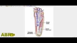 ABR Basics for Walking. By Leonid Blyum