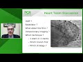 how should i treat a left main stenosis focus on the stenting technique webinar