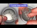 how to remove any stain from your retainer