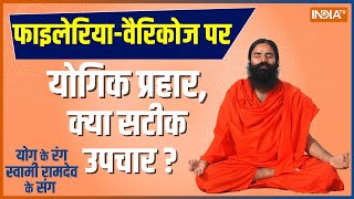 Yoga Tips by Swami Ramdev: Filaria-Varicose पर योगिक प्रहार, जानिए Swami Ramdev से सटीक उपचार