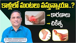 కాళ్లలో మంటలు వస్తున్నాయా..? | Burning Sensation in Feet Causes, Diagnosis | Healthy Bones