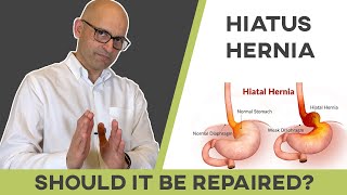 Does my Hiatus hernia need to be fixed?