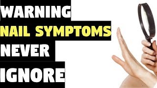 Nail Symptoms and What It Means for Your Health! | Nail Symptoms