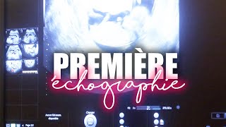 LA PREMIÈRE ÉCHOGRAPHIE (PREMIER TRIMESTRE) - VLOG GROSSESSE