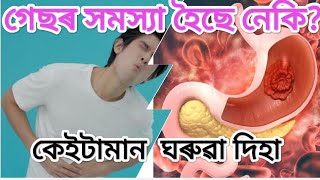 গেছৰ সমস্যা হৈছে নেকি? কি কি খাব? কি কি নাখাব? ?