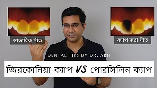 দাঁতের ক্যাপ কোনটা ভালো?  Porcelain vs E-max vs Zirconia