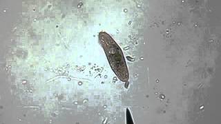 Ciliate Eating