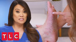 Karen's Feet Leave Dr. Lee Stumped | Dr. Pimple Popper